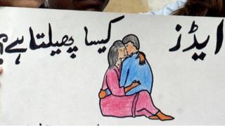 ایڈز