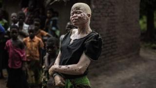 Wata zabiya a Malawi