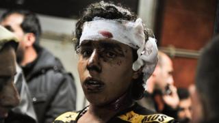 Photo released by Syrian official news agency shows an injured victim of the triple blast in Sayyida Zeinab