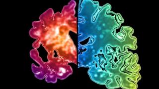 Brain