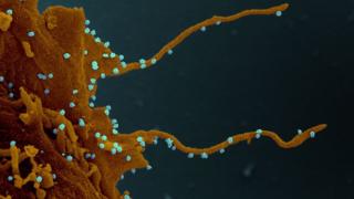 Imagem microscópica mostra filamentos de cor laranja e bolinhas azuis, que são os vírus