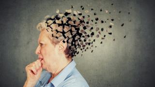 电脑图:老人的脑