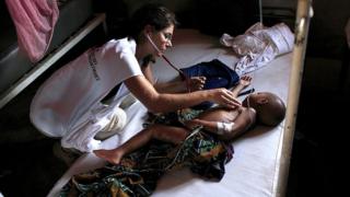 42 000 personnes ont été contaminées par la rougeole en RDC et la maladie a déjà fait 761 morts.