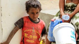 اليمن يعاني من كارثة إنسانية بحسب الأمم المتحدة