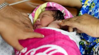 በቀዶ ህክምና መውለድ የእናቶችንና ህፃናትን ከሞት ቢታደግም፤ ከፍተኛ የጤና ችግርም ያስከትላል
