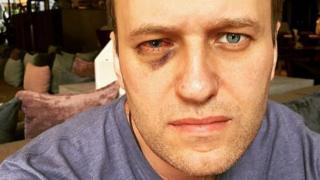 Putin critic Navalny has eye surgery in Spain after attack - BBC News