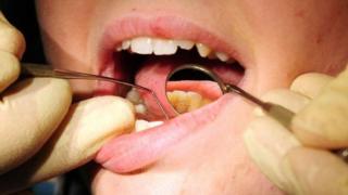 Dentista avalia boca de paciente