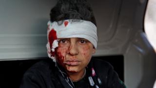 An injured Syrian boy sits inside a vehicle after a reported government air strike in Maarat Misrin, north-western Syria, on 25 February 2020