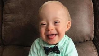 Lucas Warren tiene 18 meses y con síndrome de Down. (Foto: Gerber)