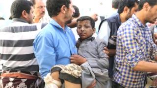 सादा प्रांतात झालेल्या हल्ल्यात जखमी झालेला मुलगा