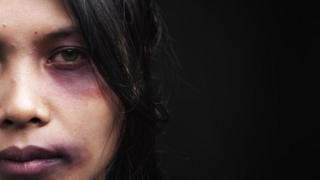 Una mujer golpeada