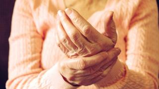 A woman holding her hands