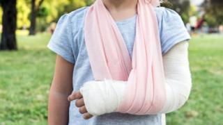Una niña con el brazo enyesado
