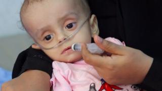 Qaramada Midoobay ayaa ka dayrisay xaaladda Yemen