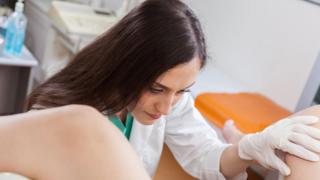smear test