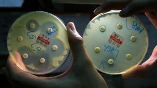 Pseudomonas aeruginosas