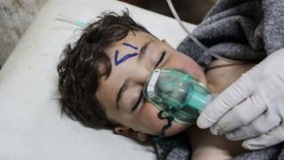 Child being treated in Syria