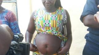 Mulher com barriga inchada