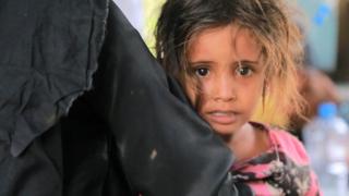 طفلة في اليمن