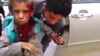 Injured boy is helped after reported air strike in Saada province, Yemen