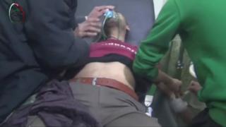 Video purportedly showing a Syrian man being treated by medics after what activists said was an attack by government forces on the Damascus suburb of Muadhamiya on 22 December 2015