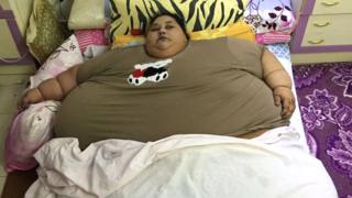 Eman Ahmed Abd El Aty ashobora kuba ari we mugore ufite ibiro byinshi kurusha abandi kw'isi