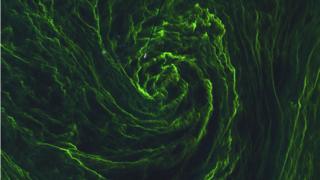 Algal bloom