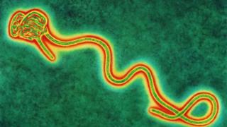Bimwe mu bimenyetso bya virusi ya Ebola birimo kuribwa umutwe, guhinda umuriro, kuribwa mu muhogo, kubabara mu ngingo, no kuruka