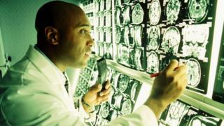 Доктор смотрит на сканирование мозга