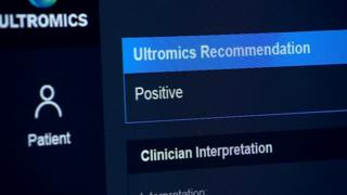 Tela do Ultromics