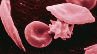 Red cells