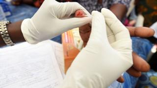 Malaria test