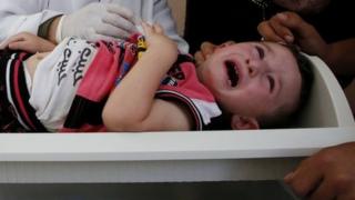 طفل فلسطيني يخضع لفحص طبي من قبل طاقم تابع للأونروا