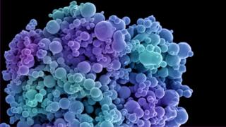 Liposomes