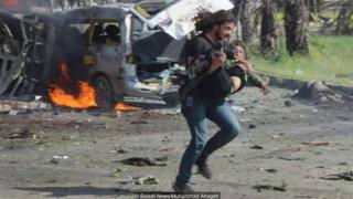 Syrian photographer Abd Alkader Habak carried a child to safety after a convoy of buses carrying evacuees from Syrian villages was bombed