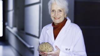 Marian diamond with a brain in hand