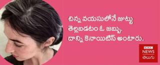 కెనాయిటిస్