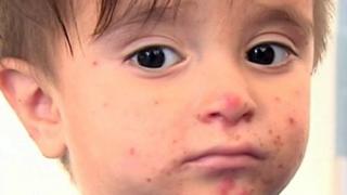 درخواست یونیسف از کشورهای عضو سازمان ملل برای رسیدگی به وضعیت کودکان مهاجر در یونان