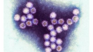 norovirus