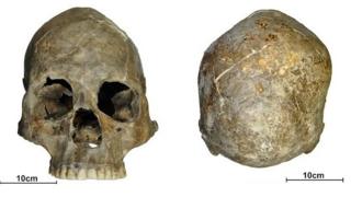 Brazil skull