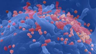 HIV particles (pink) budding from the membrane of the host cell (blue).