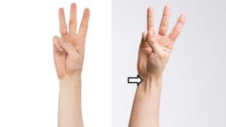 This vestigial muscle was used to help humans move around the trees