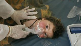 Handout photo made available by the pro-opposition Edlib Media Center on 4 April 2017 showing what is said to be a child receiving treatment at a field hospital after an alleged chemical attack in Khan Sheikhoun, Syria