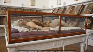 Josephinum, Collections and History of Medicine, MedUni Vienna/Photo Joanna Ebenstein