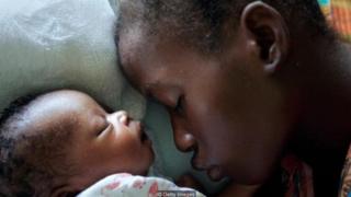 In West Africa, 4.1% of births involve a Caesarean section, below the 5% recommended rate by WHO (Credit: Getty Images)