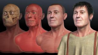 Phases of the facial reconstruction
