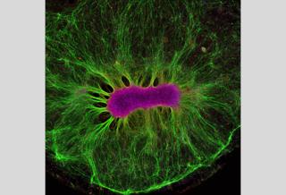 Brain-on-a-chip