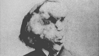 elephant man