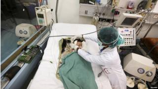 A nurse attends to a child in the intensive care unit of a government hospital in Sanaa, Yemen, June 24, 2015.
