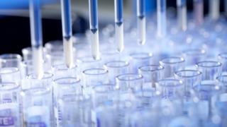 Generic image of test tubes (IMage: Science Photo Library)